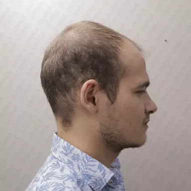 Öncesi